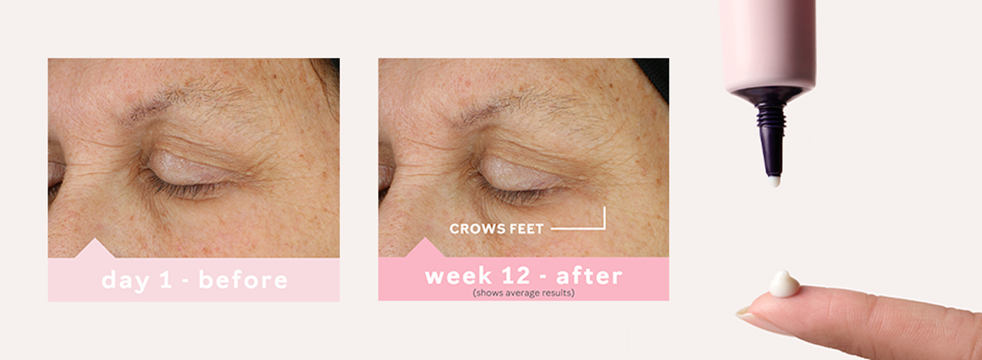 Day 1 and week 12 before and after images showing average skin improvement at the crows feet after using TimeWise Eye Cream next to an image of an open eye cream and a finger with a dollop of product on top